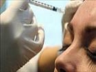 Criado com fins terapêuticos, Botox completa 20 anos