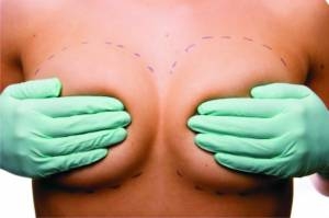 Cirurgia Plástica corrige assimetria das mamas
