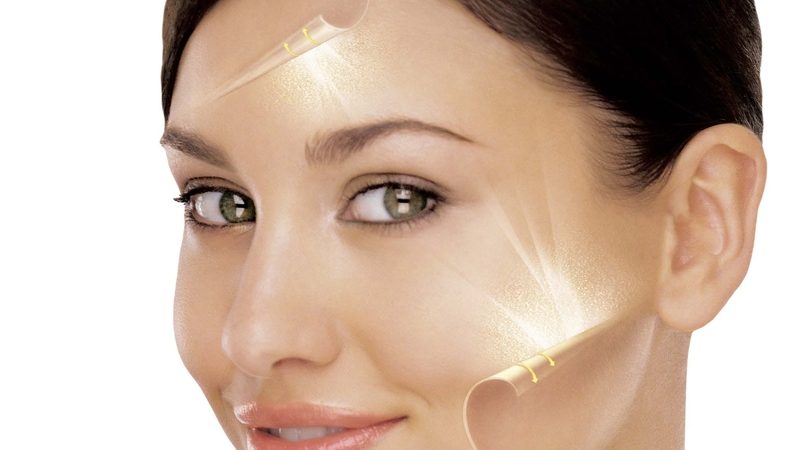 Novos tratamentos para eliminar manchas e até substituir a plástica facial