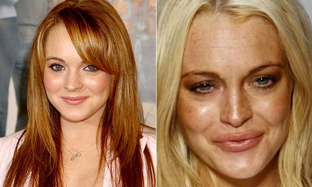 Lindsay Lohan e famosas que surpreenderam o público após procedimentos estéticos